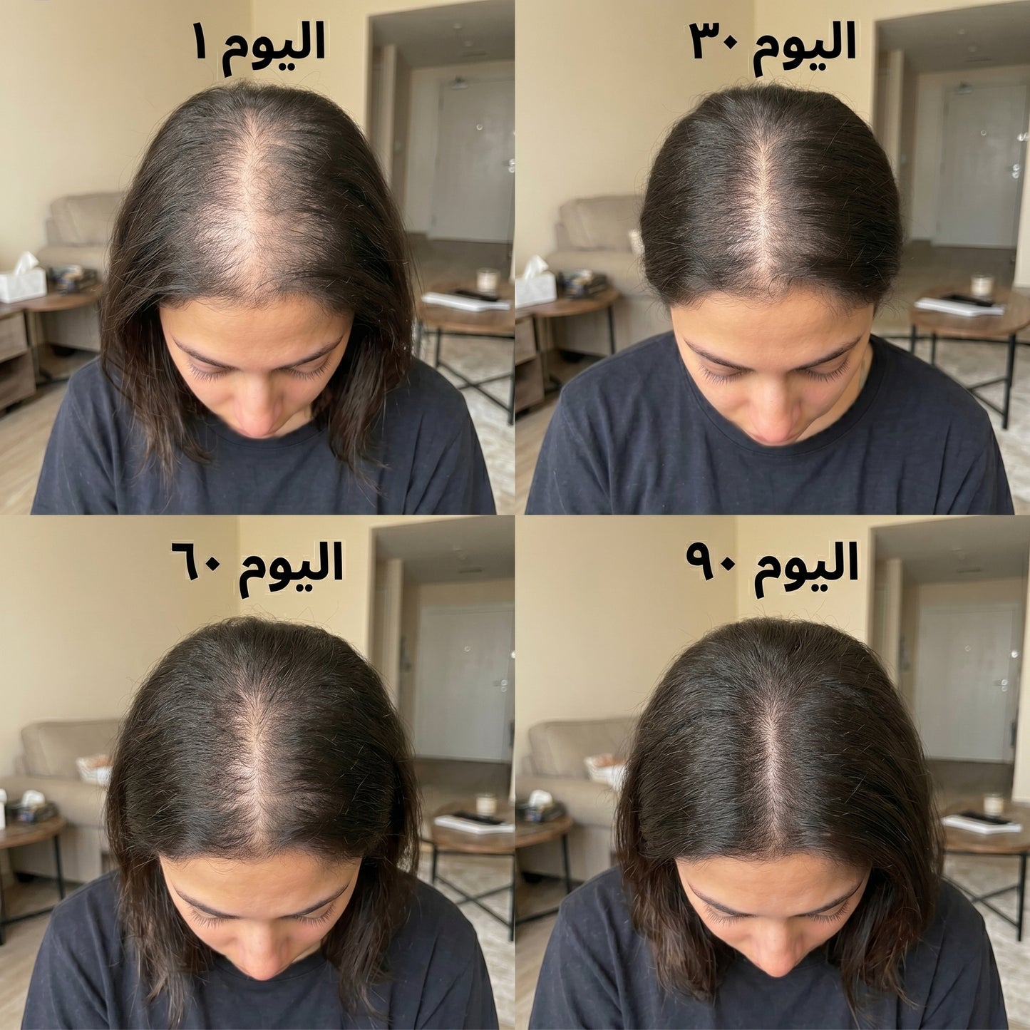 غطاء مادويز للضوء الأحمر