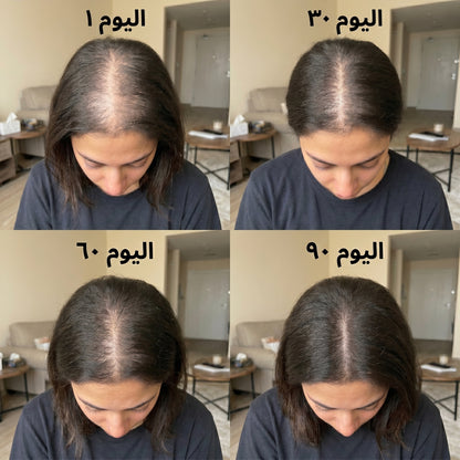 غطاء مادويز للضوء الأحمر
