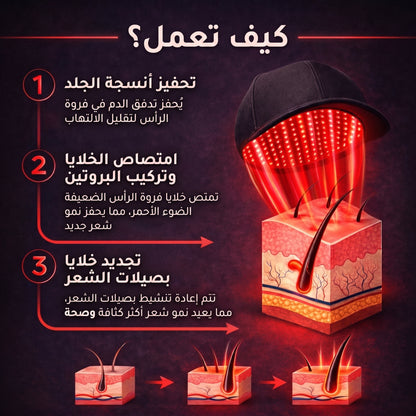 غطاء مادويز للضوء الأحمر